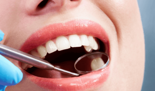Oral Cavity Clean