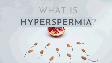 Hyperspermia