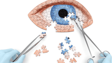 Risk Factors of Cataract Surgery