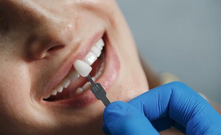 Finding the Right Cosmetic Dentist in Sydney for Your Perfect Smile
