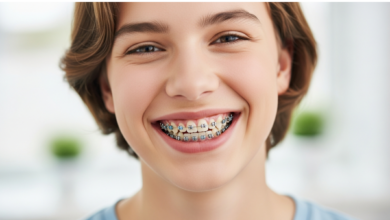 Enhance Your Smile with Advanced Orthodontic Solutions Dubai